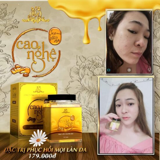 Cao Nghệ Đông Anh Collagen X3 – Hộp 30g – Hàng Chính Hãng