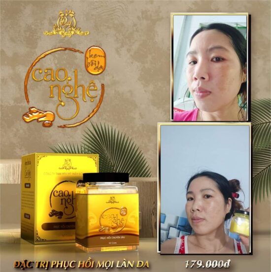 Cao Nghệ Đông Anh Collagen X3 – Hộp 30g – Hàng Chính Hãng