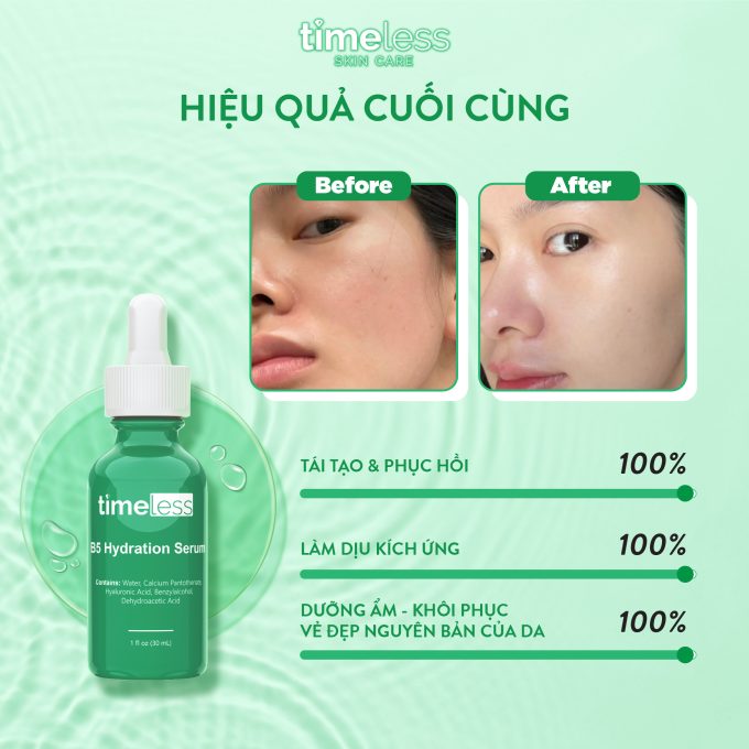 Serum Timeless Vitamin B5 Làm Dịu & Phục Hồi Da 30ml