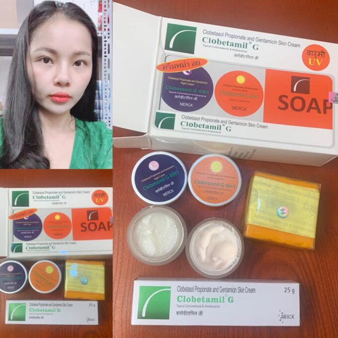 Bộ Kem Trị Nám Clobetamil G – Hàng Chuẩn Thái Lan Chính Hãng