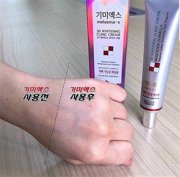 Kem Trị Nám Melasma – X 3D Whitening Clinic Cream 35ml – Hàng Chính Hãng