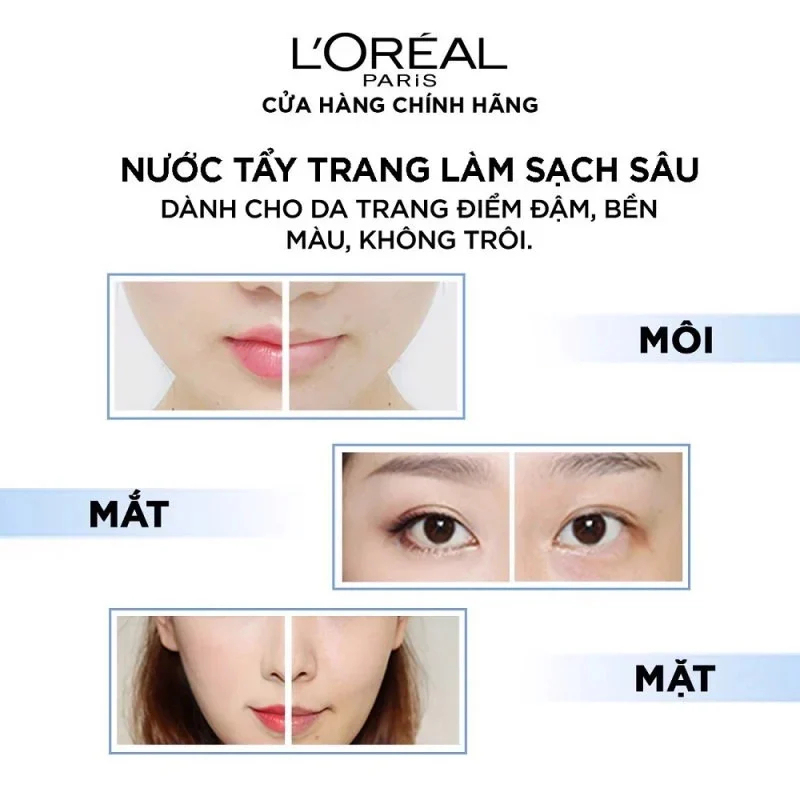 Nước Tẩy Trang Loreal 400ml – Làm Sạch Sâu Lớp Trang Điểm, Có Đủ 3 Loại